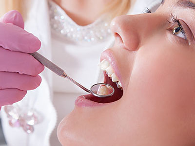 Pauly Dental | Preventative Program, Oral Exams and Dental Fillings